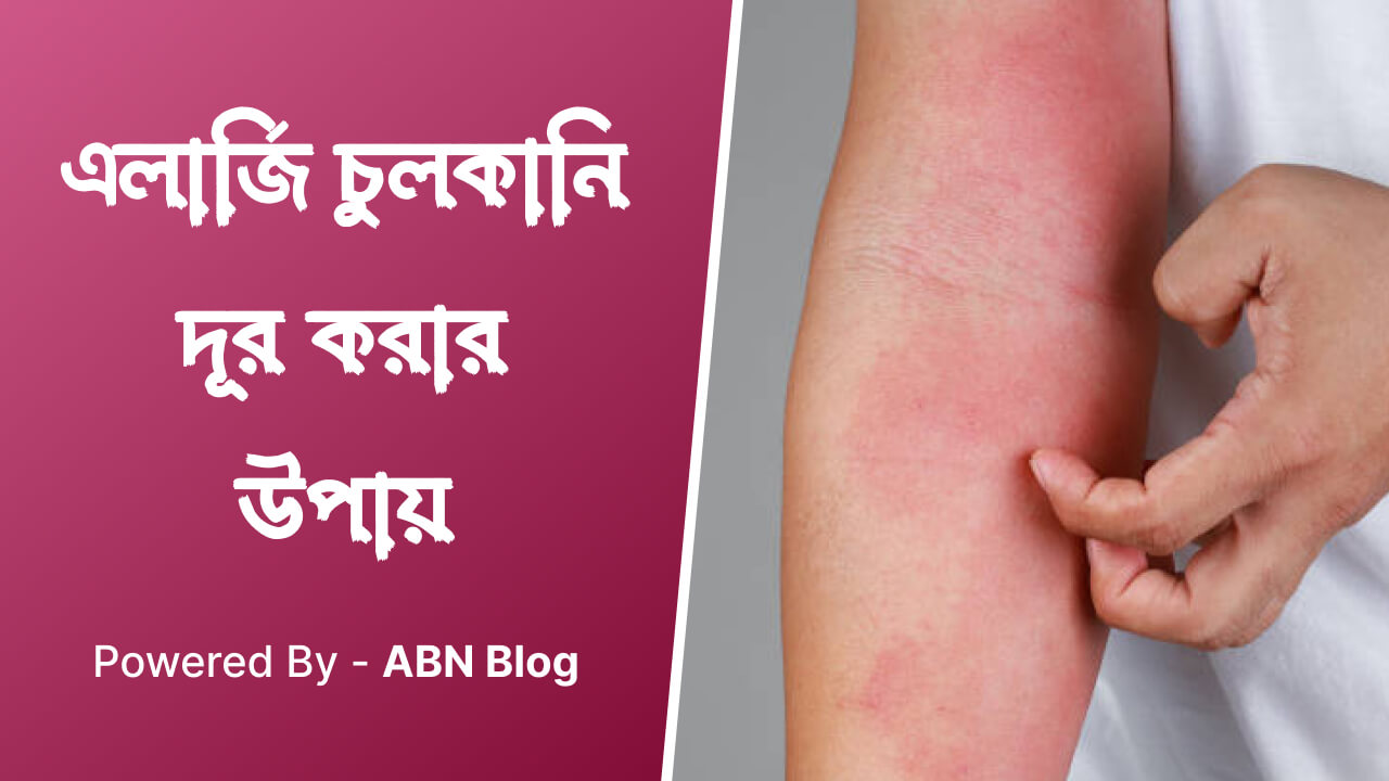এলার্জি চুলকানি দূর করার উপায়