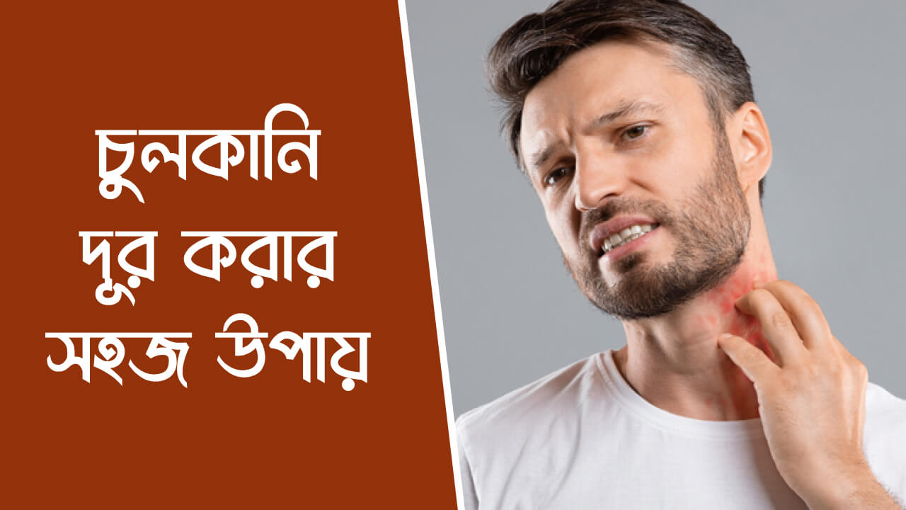 চুলকানি দূর করার উপায়