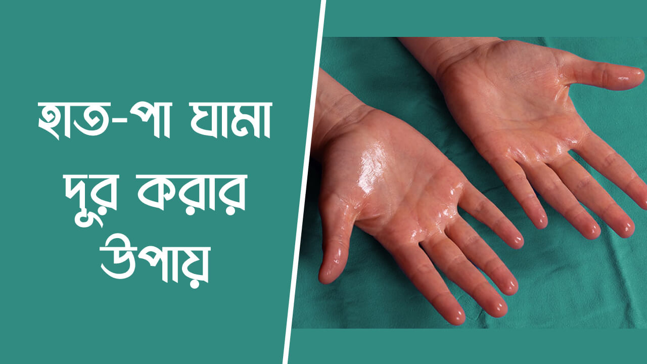 হাত পা ঘামা দূর করার উপায়